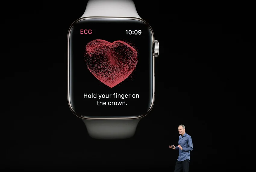Bloomberg: Apple рискует отстать в носимых устройствах, а Apple Watch теряет темп