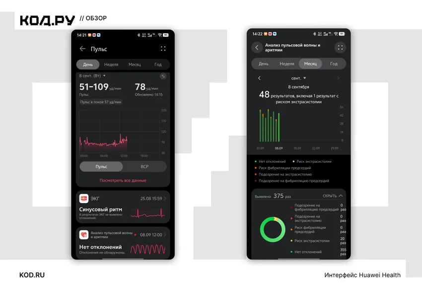 Интерфейс Huawei Health: экраны мониторинга пульса и анализа аритмии.